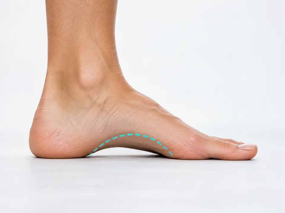 Side view of a high foot arch while standing