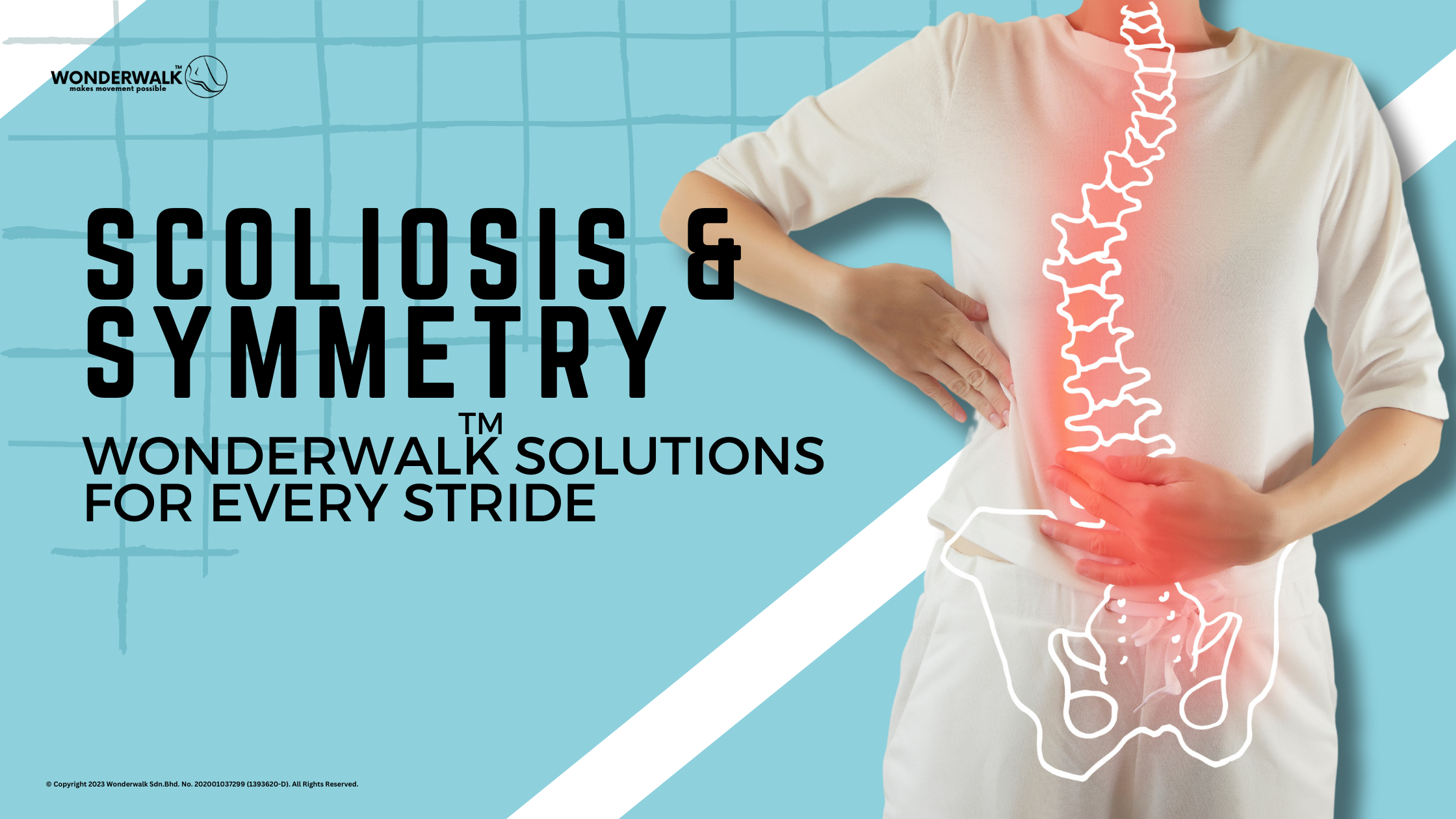 An image showcasing the impact of scoliosis on spine alignment, with visual emphasis on the lumbar region to represent the benefits of Wonderwalk Bespoke Insoles for posture correction and stride improvement.