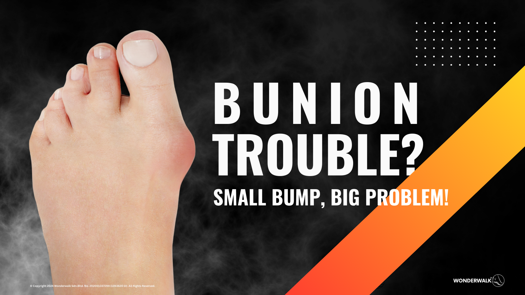 Foot with a bunion, emphasizing the message: 'Bunion Trouble? Small Bump, Big Problem!